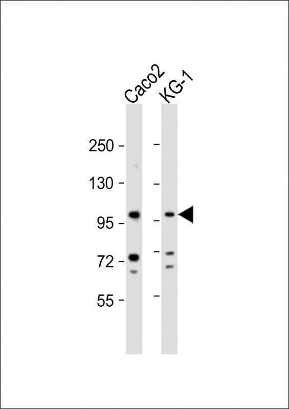 CSF3R Antibody in Western Blot (WB)