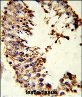 Acrosin Antibody in Immunohistochemistry (Paraffin) (IHC (P))