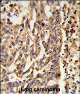 KIF11 Antibody in Immunohistochemistry (Paraffin) (IHC (P))