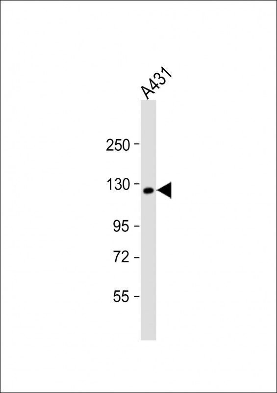 KIF11 Antibody in Western Blot (WB)