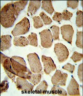 ULK1 (denatured) Antibody in Immunohistochemistry (Paraffin) (IHC (P))