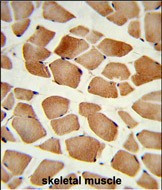 AMPD2 Antibody in Immunohistochemistry (Paraffin) (IHC (P))