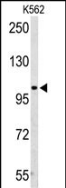 AMPD2 Antibody in Western Blot (WB)