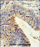 ADAMDEC1 Antibody in Immunohistochemistry (Paraffin) (IHC (P))