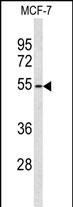 ADAMDEC1 Antibody in Western Blot (WB)