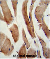 FLIP Antibody in Immunohistochemistry (Paraffin) (IHC (P))