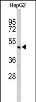 FLIP Antibody in Western Blot (WB)