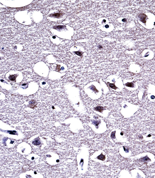 OPRM1 Antibody in Immunohistochemistry (Paraffin) (IHC (P))