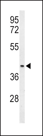 OPRM1 Antibody in Western Blot (WB)