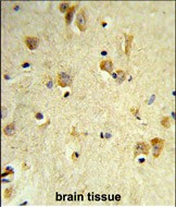 PEX14 Antibody in Immunohistochemistry (Paraffin) (IHC (P))