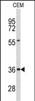 PEX16 Antibody in Western Blot (WB)