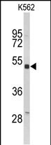 KIR3DL3 Antibody in Western Blot (WB)