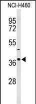 SLC25A17 Antibody in Western Blot (WB)