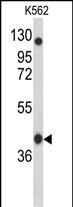 APOBEC3F Antibody in Western Blot (WB)
