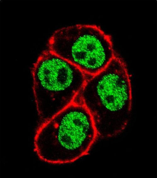 Cdc73 Antibody in Immunocytochemistry (ICC/IF)