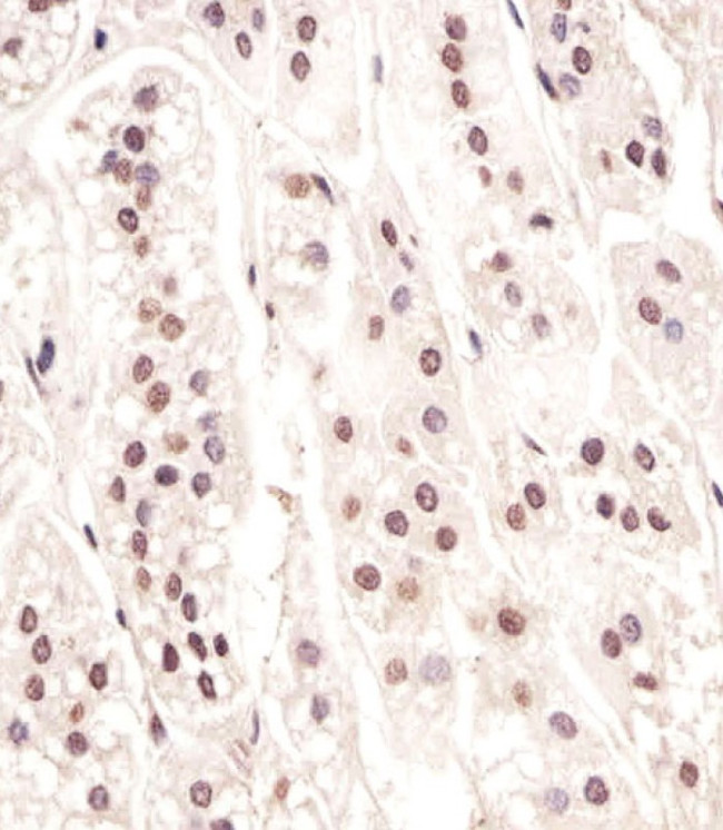 Cdc73 Antibody in Immunohistochemistry (Paraffin) (IHC (P))