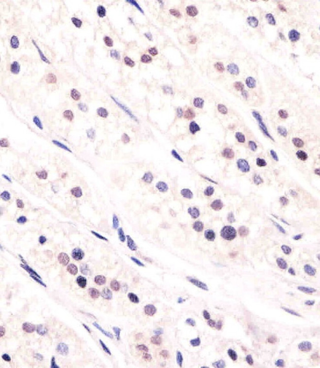 Cdc73 Antibody in Immunohistochemistry (Paraffin) (IHC (P))