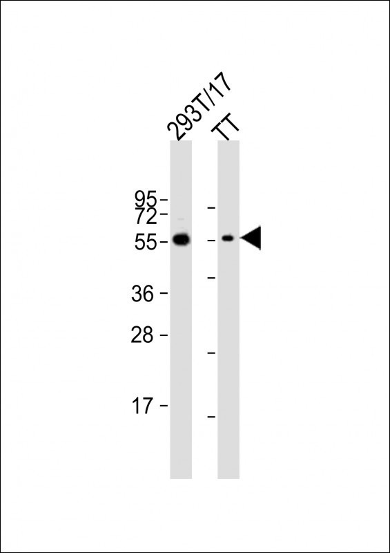 Cdc73 Antibody in Western Blot (WB)