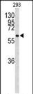 Cdc73 Antibody in Western Blot (WB)