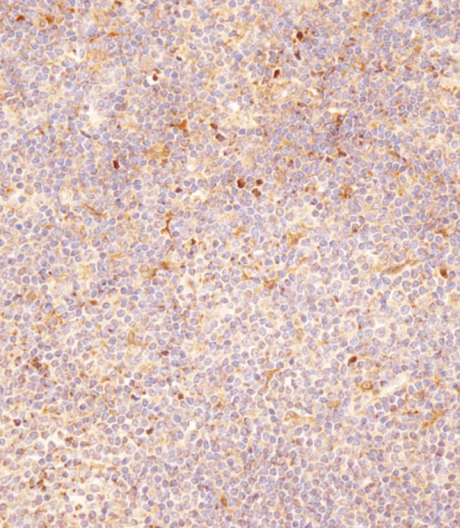 FCGR1B Antibody in Immunohistochemistry (Paraffin) (IHC (P))