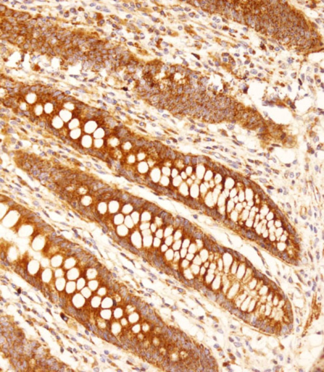 FCGR1B Antibody in Immunohistochemistry (Paraffin) (IHC (P))