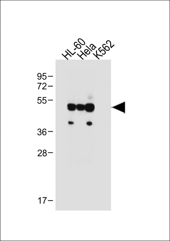 FCGR1B Antibody in Western Blot (WB)