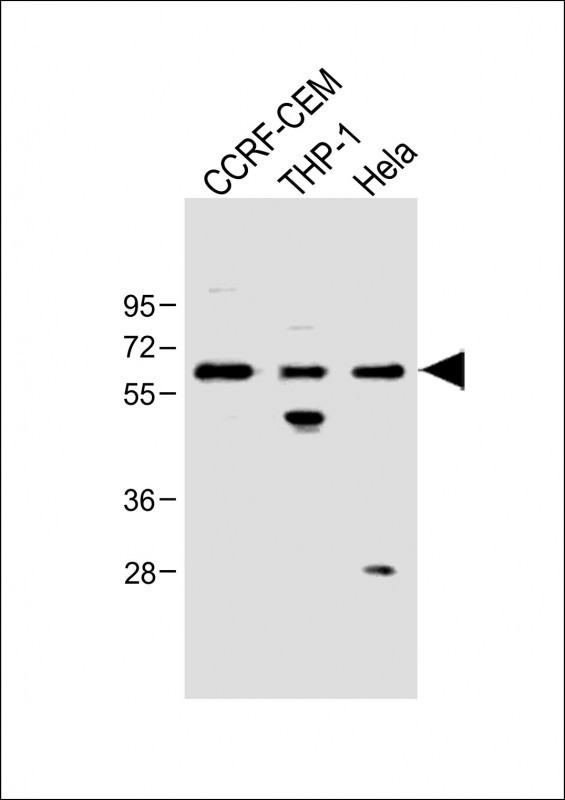 FCGR1B Antibody in Western Blot (WB)