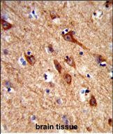 ASIC2 Antibody in Immunohistochemistry (Paraffin) (IHC (P))