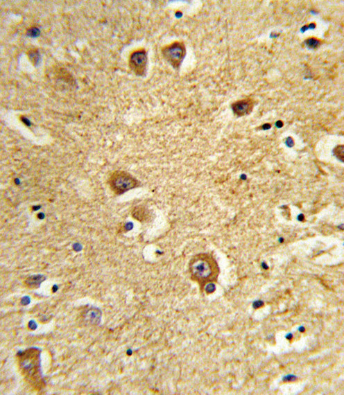 SLC22A6 Antibody in Immunohistochemistry (Paraffin) (IHC (P))