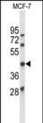 Ataxin 3 Antibody in Western Blot (WB)