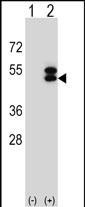 Ataxin 3 Antibody in Western Blot (WB)