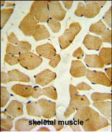 SPHK1 Antibody in Immunohistochemistry (Paraffin) (IHC (P))