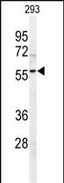 SPHK1 Antibody in Western Blot (WB)