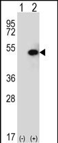 SPHK1 Antibody in Western Blot (WB)