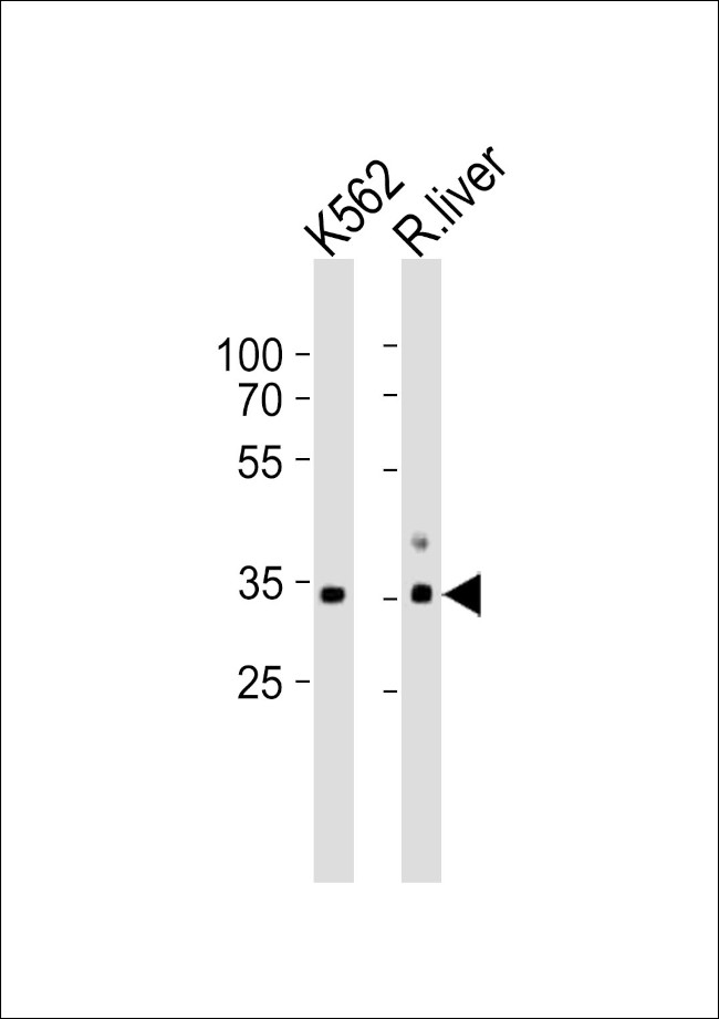 ATP1B2 Antibody in Western Blot (WB)