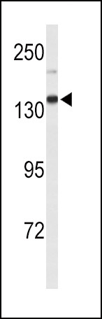 XDH Antibody in Western Blot (WB)