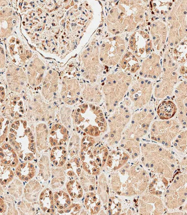 ABCF1 Antibody in Immunohistochemistry (Paraffin) (IHC (P))