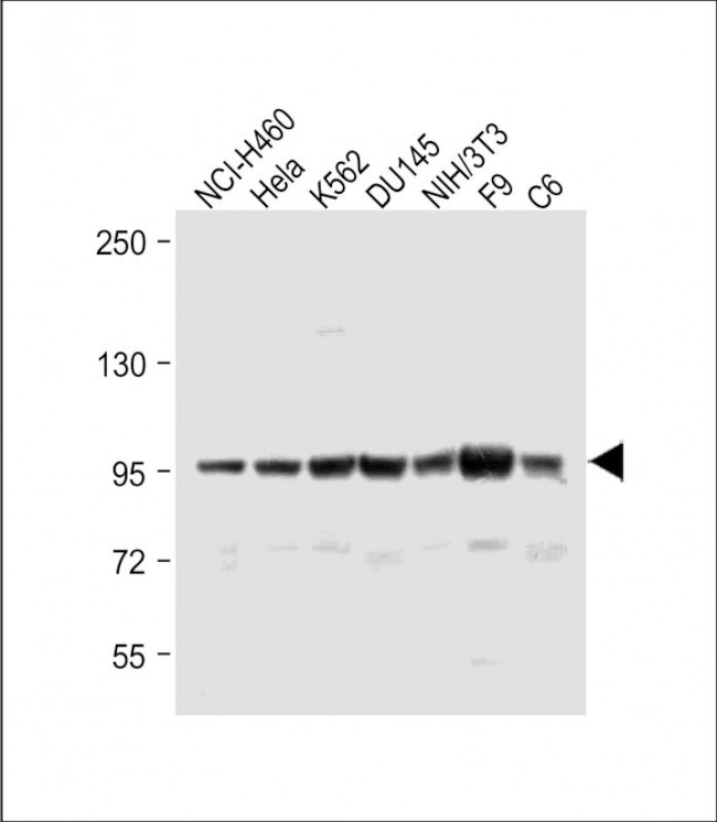 ABCF1 Antibody in Western Blot (WB)