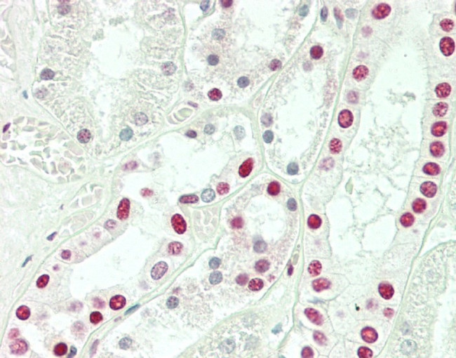 SNRPD3 Antibody in Immunohistochemistry (Paraffin) (IHC (P))