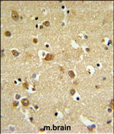 GABRD Antibody in Immunohistochemistry (Paraffin) (IHC (P))