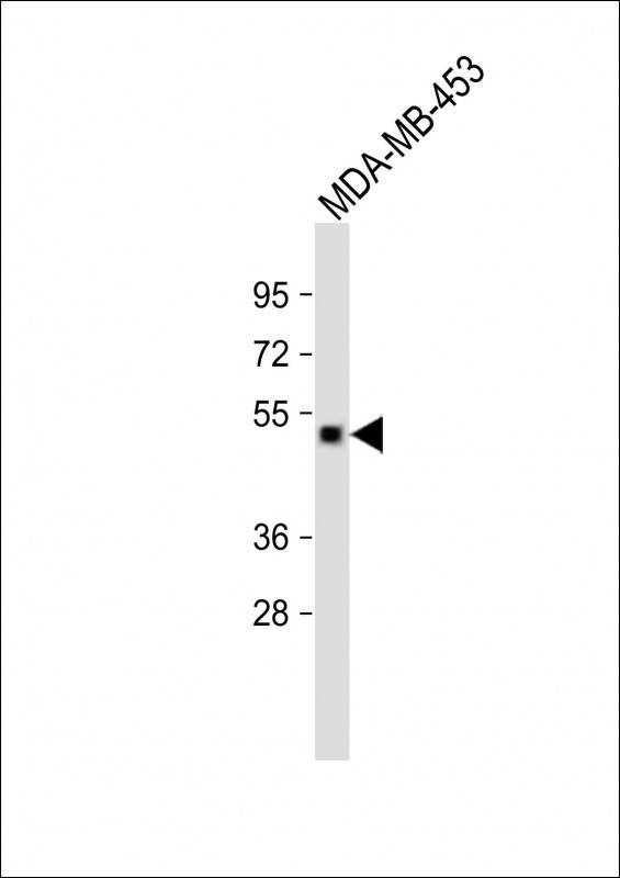 GABRD Antibody in Western Blot (WB)