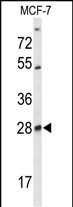 SELT Antibody in Western Blot (WB)