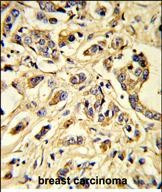 VEGF Receptor 1 Antibody in Immunohistochemistry (Paraffin) (IHC (P))