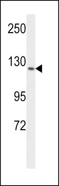 VEGF Receptor 1 Antibody in Western Blot (WB)