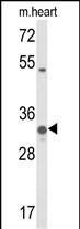 COQ5 Antibody in Western Blot (WB)