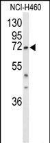 DDX17 Antibody in Western Blot (WB)