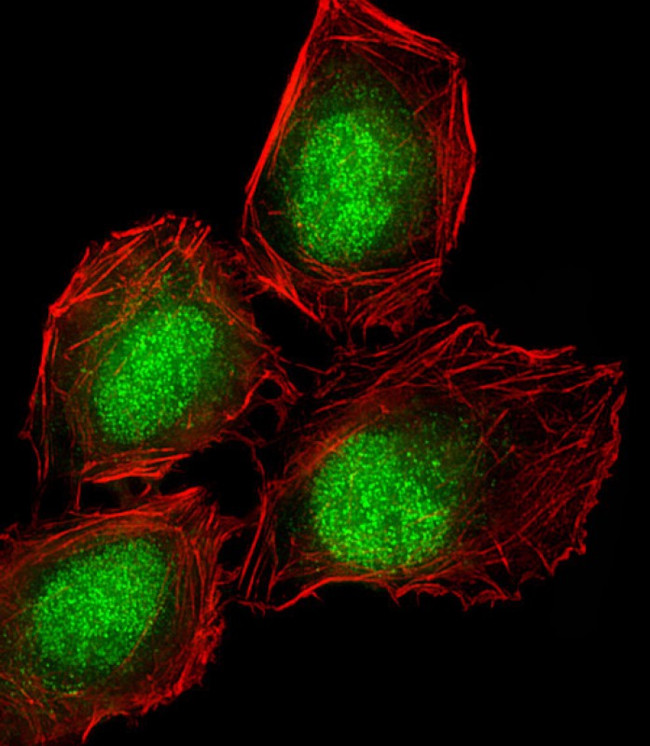 DLL3 Antibody in Immunocytochemistry (ICC/IF)