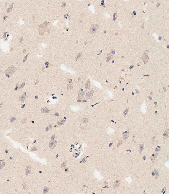 DLL3 Antibody in Immunohistochemistry (Paraffin) (IHC (P))