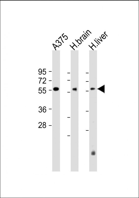 DLL3 Antibody in Western Blot (WB)