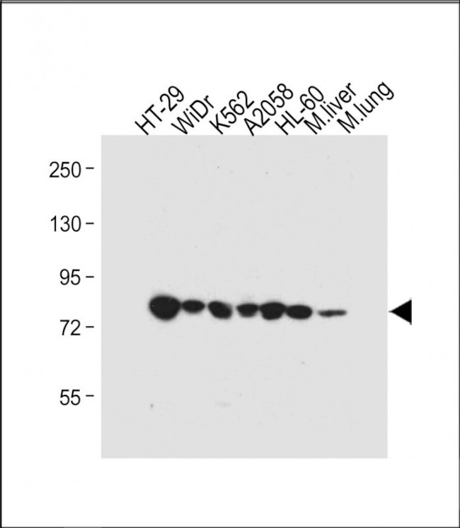 GUSB Antibody in Western Blot (WB)